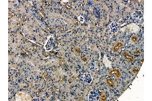 ABIN7095277 and ABIN7099334 at 1/100 staining mouse kidney tissue by IHC-P.