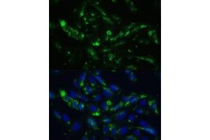 Immunofluorescence analysis of U2OS cells using CGRP antibody (ABIN6128310, ABIN6137852, ABIN6137855 and ABIN6221187) at dilution of 1:100. (CGRP Antikörper  (AA 1-141))