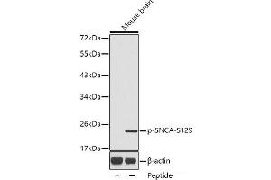 Western blot analysis of extracts from Mouse brain tissue using Phospho-SNCA(S129) Polyclonal Antibody. (SNCA Antikörper  (pSer129))