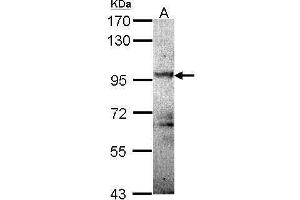 WB Image Sample (30 ug of whole cell lysate) A: Molt-4 , 7. (PKD2 Antikörper)