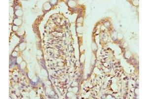 Immunohistochemistry of paraffin-embedded human small intestine tissue using ABIN7155076 at dilution of 1:100 (HPS1 Antikörper  (AA 1-324))