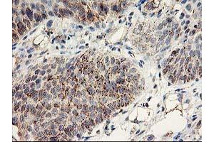 Image no. 1 for anti-DAN Domain Family, Member 5 (DAND5) (AA 23-189) antibody (ABIN1491235) (DAND5 Antikörper  (AA 23-189))
