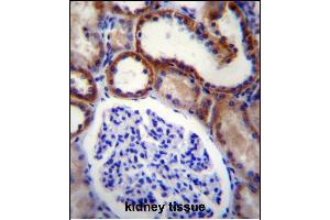 Immunohistochemistry (Paraffin-embedded Sections) (IHC (p)) image for anti-Mitogen-Activated Protein Kinase Kinase Kinase 15 (MAP3K15) (AA 315-342), (N-Term) antibody (ABIN656257)