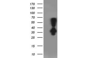 Western Blotting (WB) image for anti-Phenylethanolamine N-Methyltransferase (PNMT) antibody (ABIN1500315)