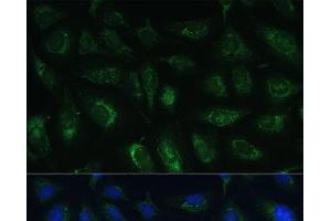 Immunofluorescence analysis of U-2 OS cells using RAPGEF1 Polyclonal Antibody at dilution of 1:100 (40x lens). (GRF2 Antikörper)