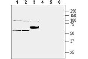 Western blot analysis of mouse lung lysate (lanes 1 and 4), rat liver lysate (lanes 2 and 5) and rat brain membranes (lanes 3 and 6): - 1-3. (SLC30A1 Antikörper  (C-Term, Intracellular))