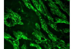 Image no. 1 for anti-Cardiotin antibody (ABIN335362) (Cardiotin Antikörper)