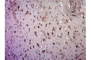 Paraformaldehyde-fixed, paraffin embedded rat brain, Antigen retrieval by boiling in sodium citrate buffer (pH6.