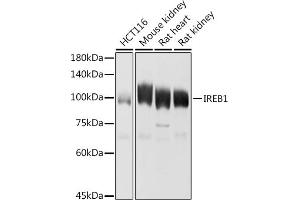 Western blot analysis of extracts of various cell lines, using IREB1 antibody (ABIN6128144, ABIN6136437, ABIN6136439 and ABIN6223846) at 1:1000 dilution. (Aconitase 1 Antikörper  (AA 1-170))