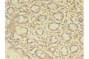 Immunohistochemistry of paraffin-embedded human small intestine tissue using ABIN7174767 at dilution of 1:100 (C19orf47 Antikörper  (AA 1-281))