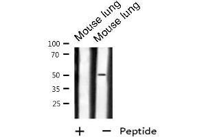 Western blot analysis of GPR180 expression in Mouse lung lysate