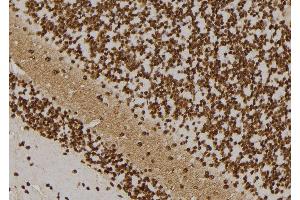Immunohistochemistry (IHC) image for anti-TATA Box Binding Protein (TBP)-Associated Factor, RNA Polymerase I, B, 63kDa (TAF1B) (Internal Region) antibody (ABIN6259211)