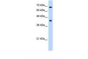 Image no. 1 for anti-Carbohydrate (N-Acetylgalactosamine 4-0) Sulfotransferase 8 (CHST8) (AA 201-250) antibody (ABIN6738605)