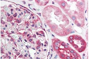 Human Kidney (formalin-fixed, paraffin-embedded) stained with TNFRSF10A antibody ABIN214531 at 5 ug/ml followed by biotinylated goat anti-rabbit IgG secondary antibody ABIN481713, alkaline phosphatase-streptavidin and chromogen. (TNFRSF10A Antikörper)