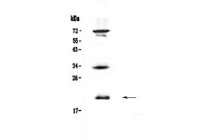 Western blot analysis of IL17B  using anti-IL17B  antibody . (IL17B Antikörper  (AA 23-180))