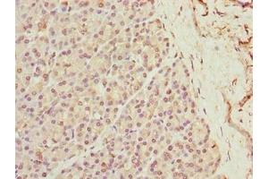 Immunohistochemistry of paraffin-embedded human pancreatic tissue using ABIN7175917 at dilution of 1:100 (xpr1 Antikörper  (AA 529-696))