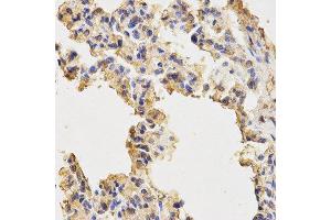 Immunohistochemistry (IHC) image for anti-Microtubule-Associated Protein 1 Light Chain 3 alpha (MAP1LC3A) antibody (ABIN1876819) (MAP1LC3A Antikörper)