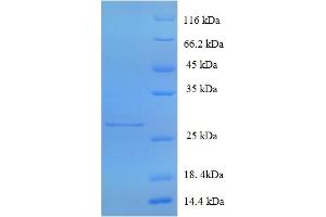 SDS-PAGE (SDS) image for Glutamate Receptor, Ionotropic, AMPA 3 (GRIA3) (AA 151-250), (partial) protein (His-SUMO Tag) (ABIN5709613)