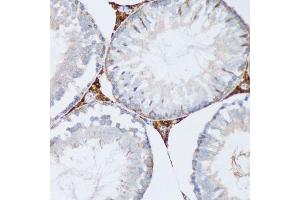 Immunohistochemistry (Paraffin-embedded Sections) (IHC (p)) image for anti-Progesterone Receptor Membrane Component 1 (PGRMC1) (AA 44-195) antibody (ABIN6145520)