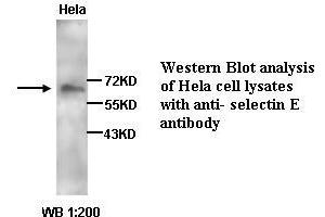 Image no. 1 for anti-Selectin E (SELE) antibody (ABIN790883) (Selectin E/CD62e Antikörper)