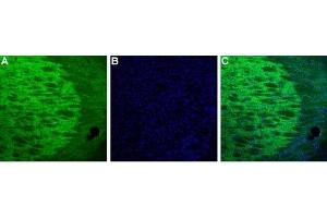 Expression of HCN4 in mouse thalamusImmunohistochemical staining of mouse thalamus using Guinea pig Anti HCN4 Antibody (ABIN7043283, ABIN7045364 and ABIN7045365). (Hyperpolarization Activated Cyclic Nucleotide-Gated Potassium Channel 4 (HCN4) Peptid)