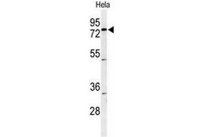 Western blot analysis of CLPTM1 Antibody (Center) in Hela cell line lysates (35µg/lane). (CLPTM1 Antikörper  (Middle Region))