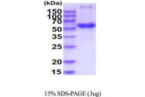SDS-PAGE (SDS) image for Frizzled Family Receptor 4 (FZD4) (AA 37-222) protein (hIgG-His-tag) (ABIN5854966)