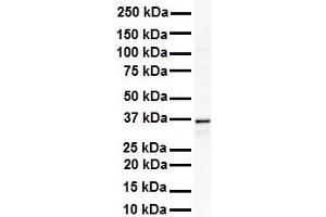 WB Suggested Anti-GAPDH antibody Titration: 1 ug/mL Sample Type: Human Raji (GAPDH Antikörper  (Middle Region))