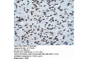 Rabbit Anti-Q9HB14 Antibody  Paraffin Embedded Tissue: Human Brain Cellular Data: Neural Cells Antibody Concentration: 4. (KCNK13 Antikörper  (C-Term))