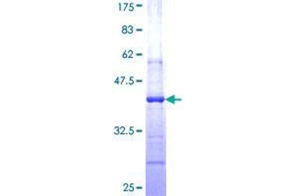 AGO1 Protein (AA 101-200) (GST tag)