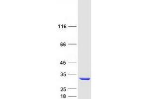 Validation with Western Blot
