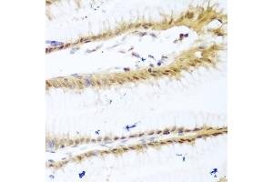 Immunohistochemistry of paraffin-embedded human stomach using UNG antibody (ABIN6133476, ABIN6149934, ABIN6149936 and ABIN6216305) at dilution of 1:100 (40x lens). (UNG Antikörper  (AA 1-313))