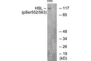 Western blot analysis of extracts from K562 cells, using HSL (Phospho-Ser552) Antibody.