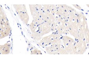 Immunohistochemistry (IHC) image for anti-Myosin Heavy Chain 7, Cardiac Muscle, beta (MYH7) (AA 1777-1935) antibody (ABIN7428827)