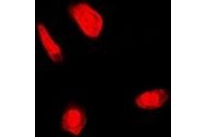 Immunofluorescent analysis of FANCC staining in U2OS cells.