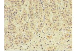 Immunohistochemistry of paraffin-embedded human adrenal gland tissue using ABIN7145562 at dilution of 1:100 (EPHX2 Antikörper  (AA 1-555))
