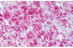 Anti-ACAT1 antibody IHC staining of human adrenal cortex.