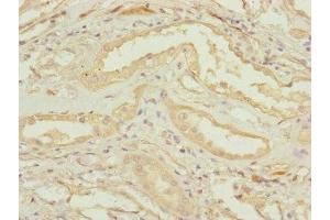 Immunohistochemistry of paraffin-embedded human kidney tissue using ABIN7147433 at dilution of 1:100