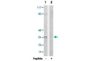 Western blot analysis of extracts from HepG2 cells, using CA13 polyclonal antibody . (CA13 Antikörper)
