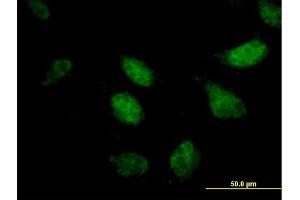 Immunofluorescence of purified MaxPab antibody to ZNF342 on HeLa cell. (Zinc Finger Protein 296 (ZNF296) (AA 1-475) Antikörper)