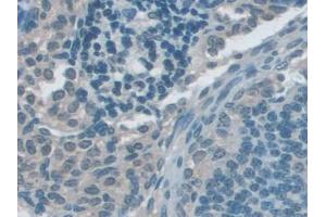 DAB staining on IHC-P; Samples: Mouse Ovary Tissue