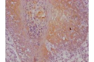 IHC image of ABIN7180967 diluted at 1:100 and staining in paraffin-embedded human tonsil tissue performed on a Leica BondTM system.