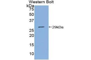 Western Blotting (WB) image for anti-Protein Inhibitor of Activated STAT, 1 (PIAS1) (AA 409-645) antibody (ABIN3206150) (PIAS1 Antikörper  (AA 409-645))