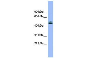 SPINT1 antibody used at 1 ug/ml to detect target protein. (SPINT1 Antikörper  (Middle Region))
