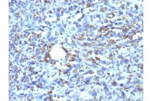 Formalin-fixed, paraffin-embedded human Histiocytoma stained with CD68 Recombinant Mouse Monoclonal Antibody (rLAMP4/824). (Rekombinanter CD68 Antikörper)