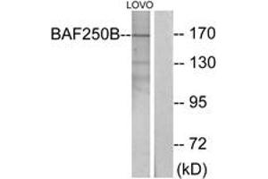 Western blot analysis of extracts from LOVO cells, using BAF250B Antibody. (ARID1B Antikörper  (AA 1371-1420))