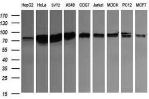 Image no. 3 for anti-CD22 Molecule (CD22) antibody (ABIN1497211) (CD22 Antikörper)