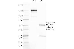 SDS-PAGE Analysis Purified CFTR Mouse Monoclonal Antibody (CFTR/1785). (CFTR Antikörper  (AA 258-385))