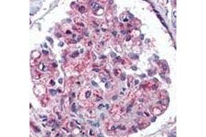 Immunohistochemistry (IHC) image for anti-Ubiquitin (Ub) (AA 1-32) antibody (ABIN3029419)