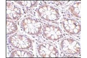 Immunohistochemistry of STEAP2 in human colon tissue with this product at 2. (STEAP2 Antikörper  (C-Term))